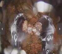 福岛核电站2号机组燃料碎片长啥样？
